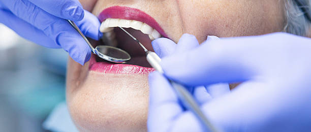 Best Emergency Treatment for Dental Infections or Abscesses in Frankston, TX
